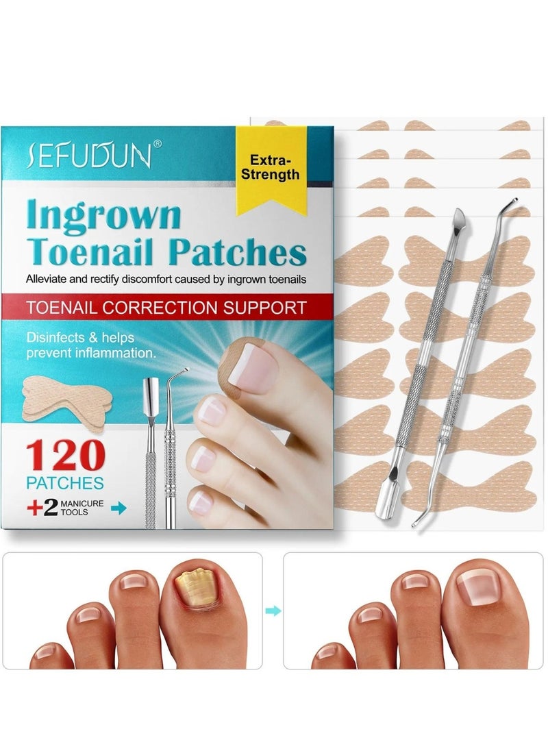120 pcs Ingrown Toenail Corrector Patches with 2 Manicure Tools Ingrown Toenail Correction Stickers for Toenail Repair Glue Free Ingrown Toenail Corrector Strips Toenail File Patches