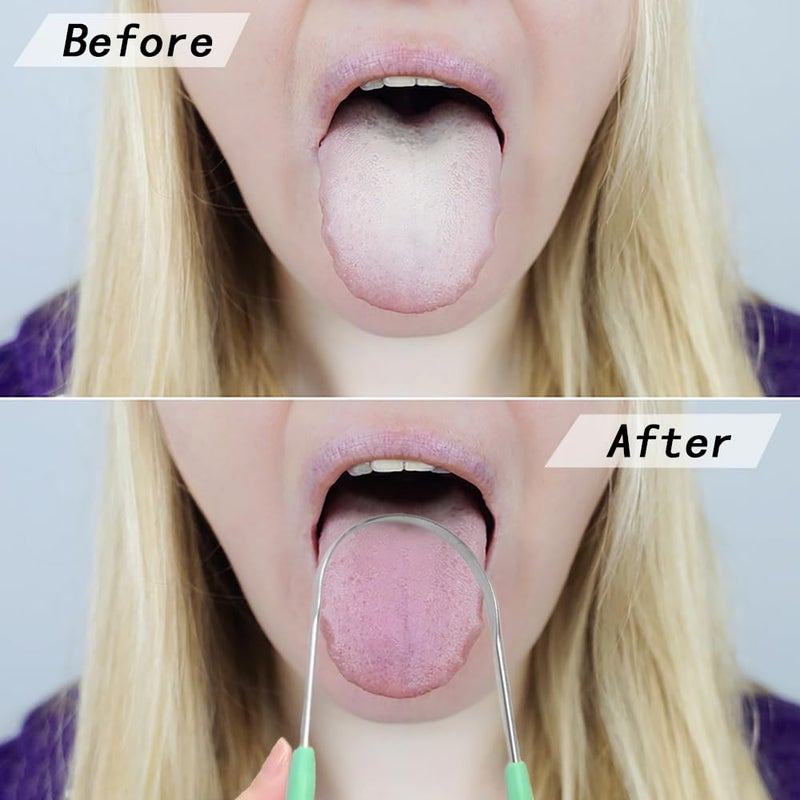 TRKETK 4 Pezzi Tongue Scraper, Tongue Cleaner U Shape Tongue Scraper Stainless Steel Tongue Cleaning Scraper Tongue Scrape, Removes Bad Breath Fresh Breath - Image 5