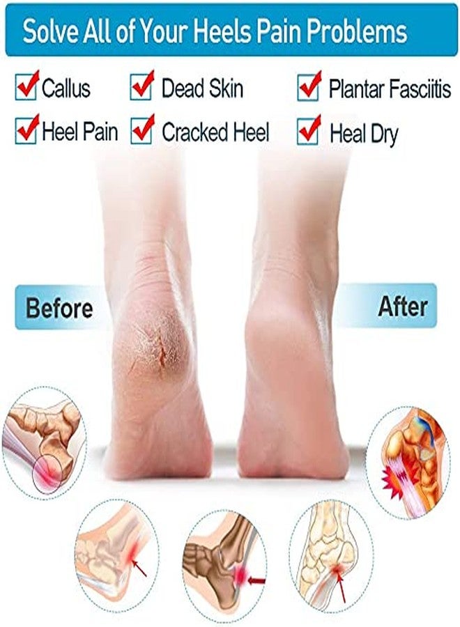 DIGSMORDEN Heel anti crack set for women Shock, gel, Protector Socks Foot Protector Silicon Toe Free Heel Pain Relief Socks For Men And Women - Image 2