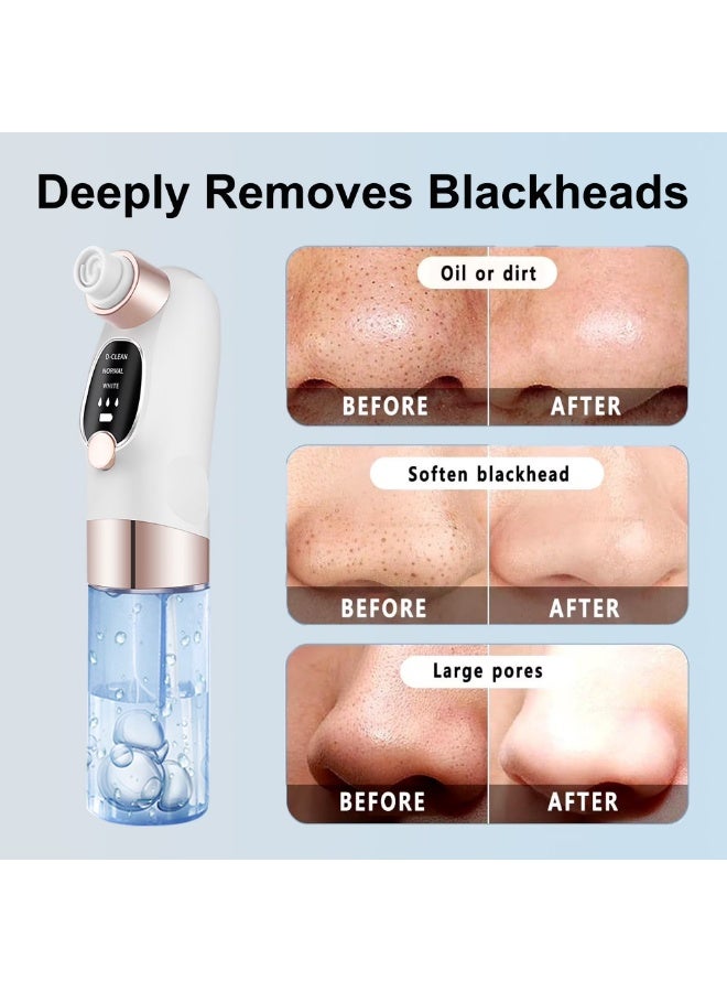 Facial blackhead suction device, pore cleansing device with water cycle technology, equipped with three suction levels and six heads for deep cleansing and skincare, electric facial cleansing tool for women and men - Image 3