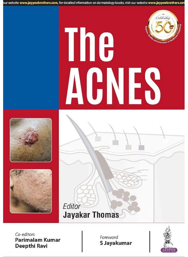 The Acnes  - Image 1