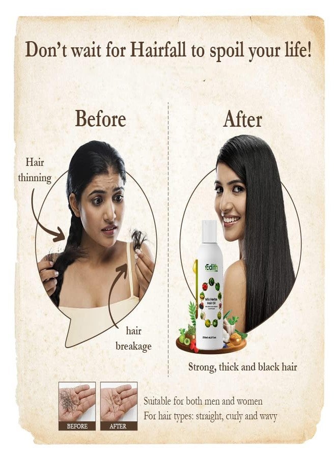 EDITH زيت إديث ناتشورالز العشبي للشعر - حل شامل لمشاكل الشعر لدى الرجال والنساء | تركيبة طبيعية 100% - 200 مل - Image 3