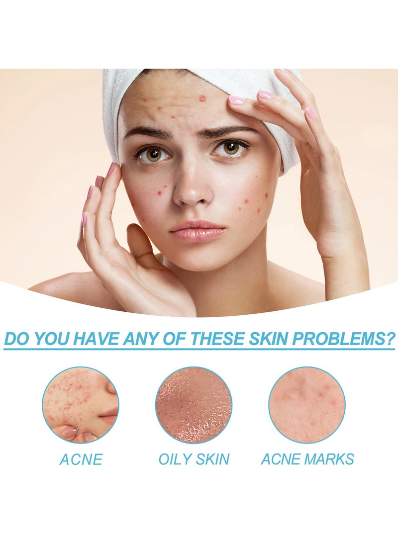 OUHOE - Salicylic acid acne repair gel. Repair facial closed comedones. Fade acne marks and blackheads. - Image 1
