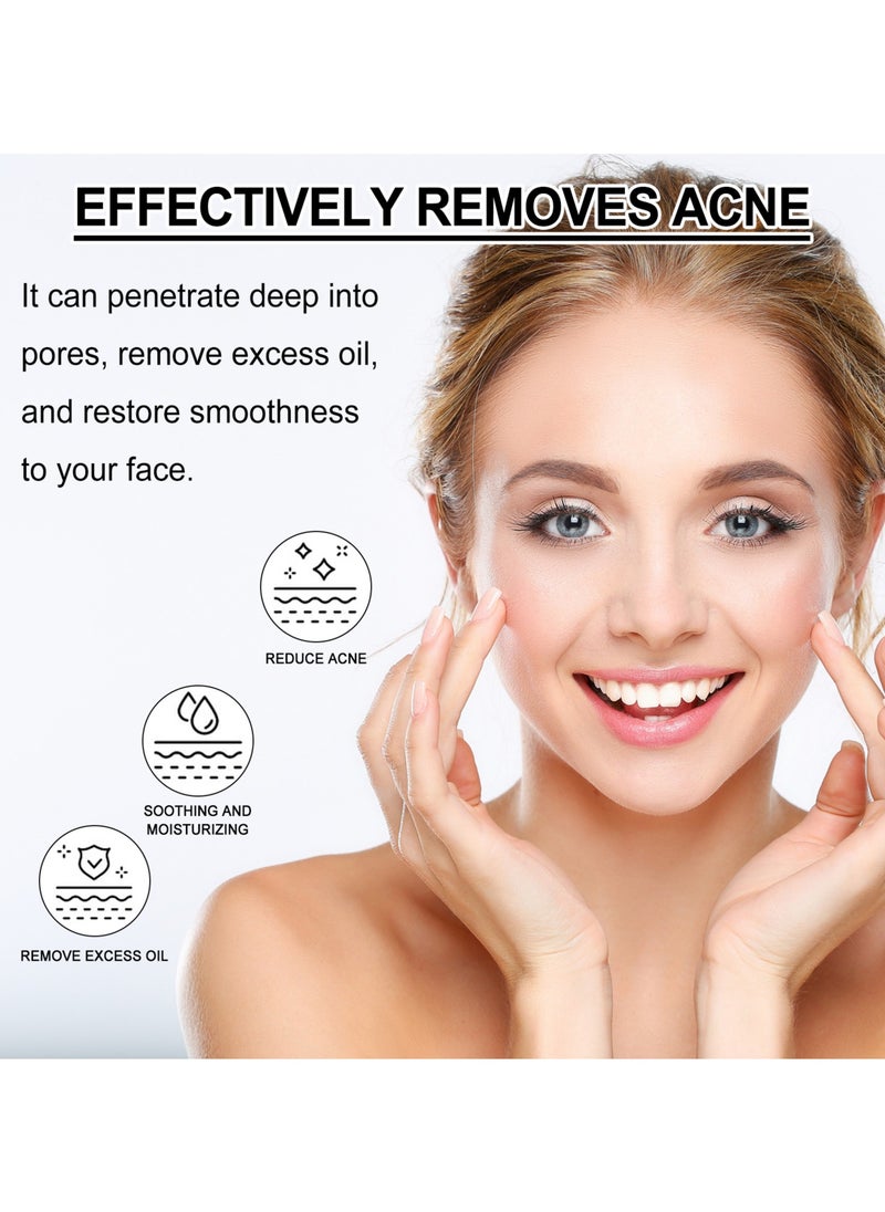 OUHOE - Salicylic acid acne repair gel. Repair facial closed comedones. Fade acne marks and blackheads. - Image 1