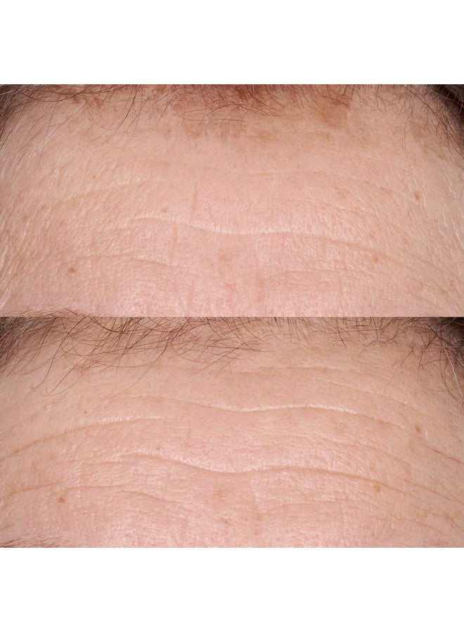 Perricone MD Hypoallergenic Clean Correction Smoothing Restorative Serum 2 Fl. Oz. - Image 5