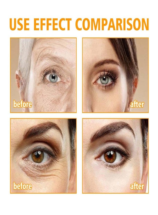 كريم عيون WUEOCU Beauty مع ببتيدات 5D، كريم عيون مع ببتيدات 5D، كريم عيون بالببتيدات، كريم عيون مضاد للشيخوخة، للهالات السوداء والانتفاخات، يرطب البشرة تحت العينين (عبوتان) - Image 2