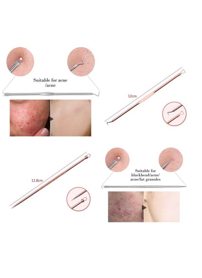 Y&D Blackhead Remover Pimple Popper Tool Kit, Acne Zit Extractor for Nose Face, Stainless Steel Whitehead Popping Removal 4 Pcs  - Image 4