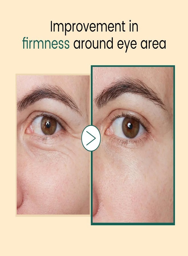 YAFUSIPE Eye Serum for Dark Circles and Puffiness, Salmon DNA PDRN Eye Treatment Serums with Peptides and Niacinamide Puffy Eyes Roller Serum Under Eye Bags, Revive Eyes Serum for Anti-wrinkle 0.5 fl.oz - Image 2