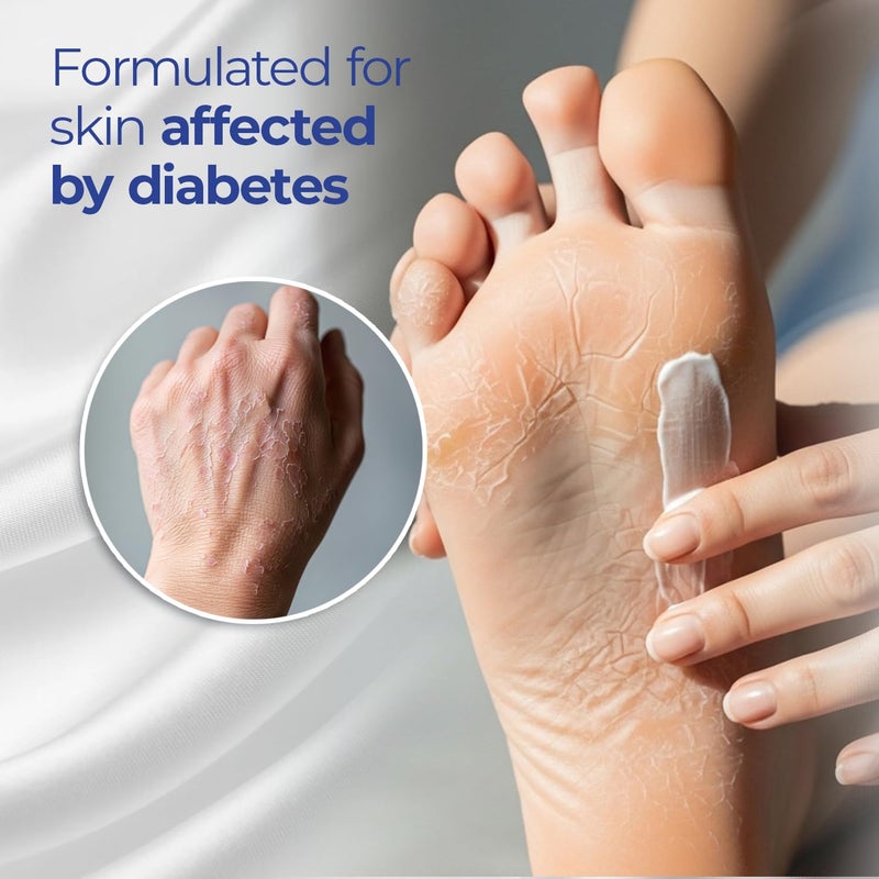 Goicoechea Diabet TX Diabetic Lotion with Urea for Dry Skin | Soothing Hydrating Cream with Aloe, Oatmeal & Vitamin E for Hands, Elbows, Feet & Body | Extra Dry Skin Support, 13.5 Oz | 3-Pack - Image 3
