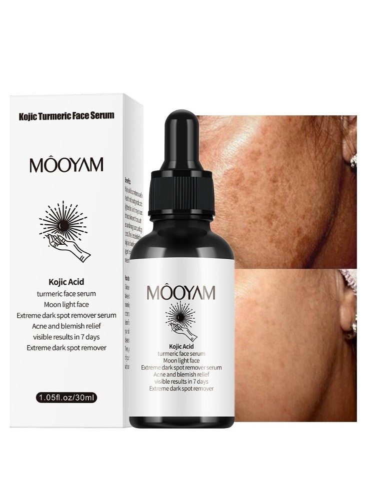 MOOYAM Turmeric Kojic Acid Serum Dark Spot Corrector Serum, Dark Spot Remover Serum for Face and Body, Skin Brightening Face Serum Reduces Hyperpigmentation, Age Spots, Sun Spot - 30ml  - Image 1