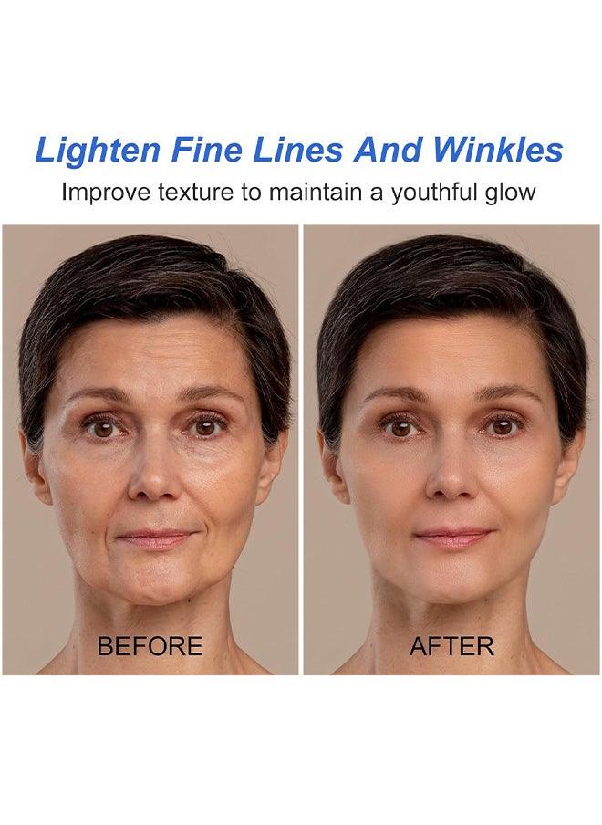 Sefudun - Botox Stock Solution Anti Aging Serum For Lightens Fine Lines, Improves Folds, Anti-Wrinkles, Instant Face Tightening Botox, Reduce Fine Lines, Wrinkles, Supplementing Skin Collagen - Image 1