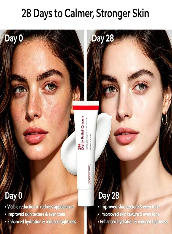تي دبليو إل بي اكس ام جي كريم TWLBXMG 3H Daily Relief، مرطب وملطف للوجه مع حمض الهيالورونيك، كريم لإصلاح حاجز البشرة المتضررة، 50 مل - Image 5