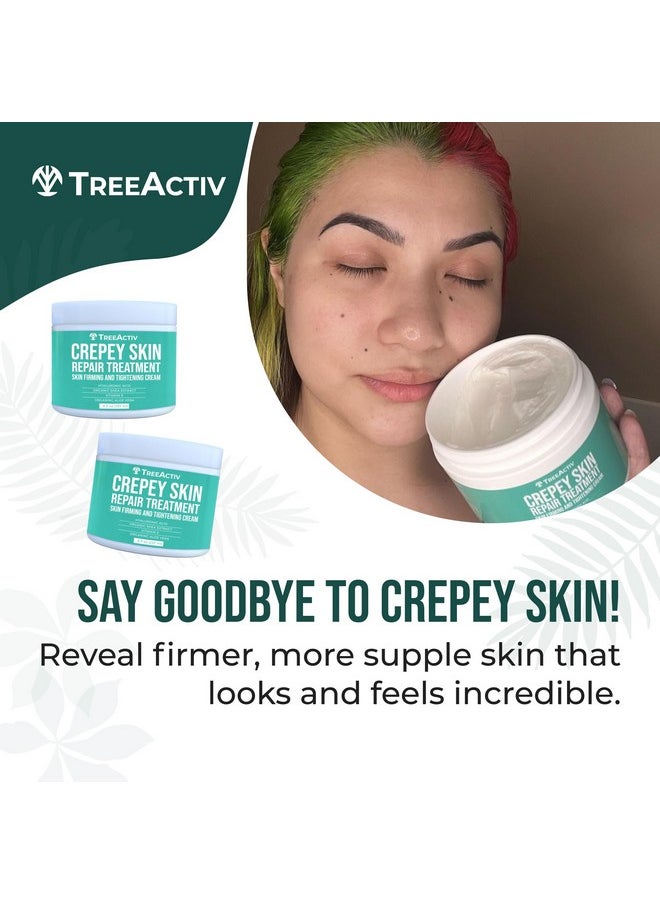 TreeActiv TreeActiv Crepey Skin Repair Treatment, 2-Pack, Firming Cream For Face and Neck, Skin Firming and Tightening Lotion with Hyaluronic Acid, Crepey Skin Treatment to Moisturize Dry Crepe Skin, 1000+ Uses  - Image 3