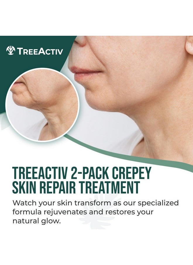 TreeActiv TreeActiv Crepey Skin Repair Treatment, 2-Pack, Firming Cream For Face and Neck, Skin Firming and Tightening Lotion with Hyaluronic Acid, Crepey Skin Treatment to Moisturize Dry Crepe Skin, 1000+ Uses  - Image 2