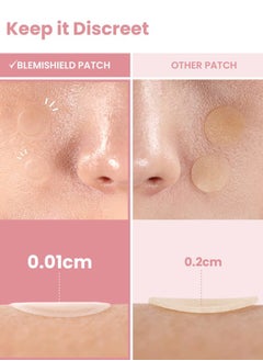 Glam Up Hydrocolloid Blemish Pimple Zit Patches - Invisible Ultra Thin Spot Cover Stickers for Face and Skin, Strong Water-proof and Adhesive Overnight Thin & Invisible (72 Count / 2 Sizes)  - Image 4