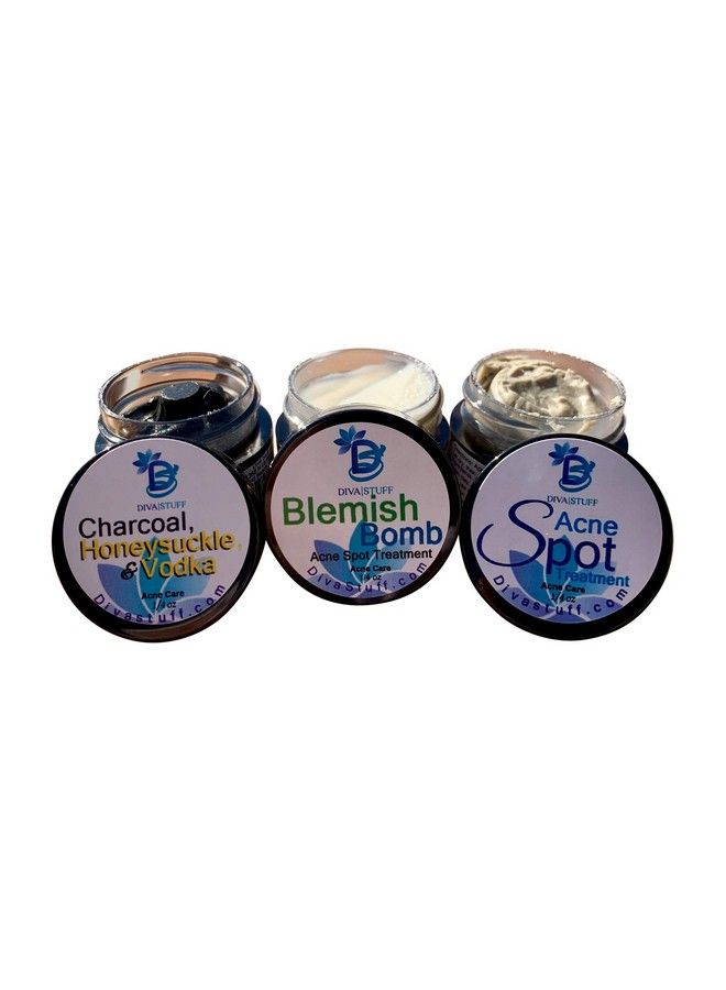 Diva Stuff Acne Spot Treatments3 Different Kinds For Moderate Acne To Cystic Acne  - Image 2