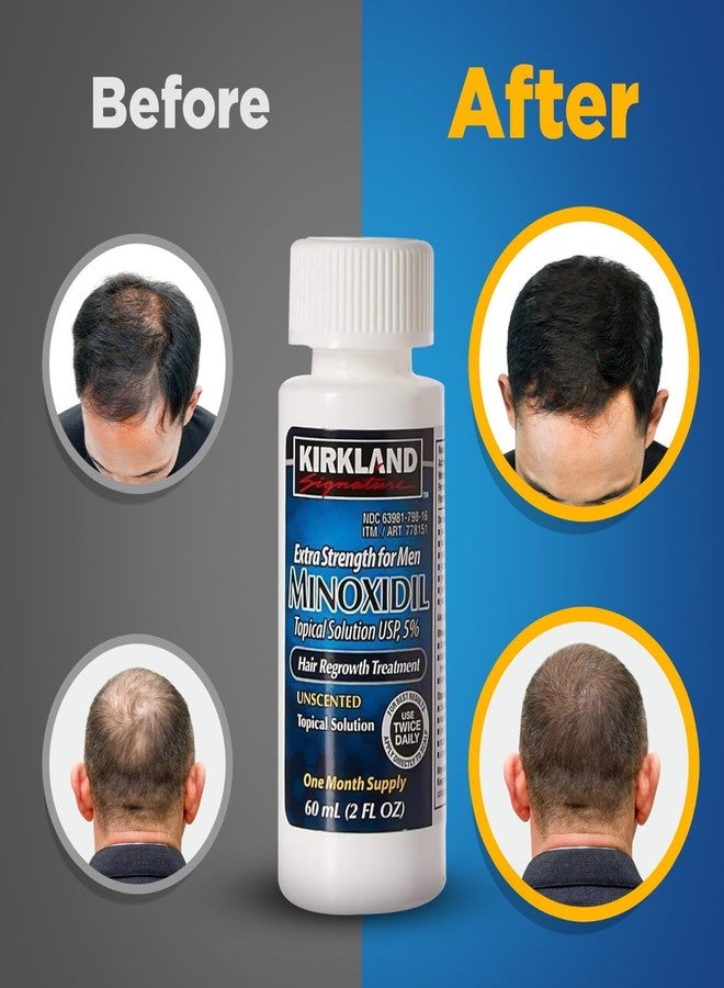 Kirkland Signature 5% Minoxidil Hair Regrowth for Men - 1 Month Supply - Image 2