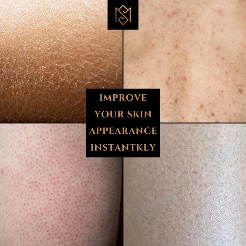 MS Exfoliating Glove Kessa Mitt Body Scrubber - Dead Skin Remover Shower Glove for Dead Skin Scrubbing and Deep Pore Cleansing - by MoroccanSource (1 Pack Black with soap Sample) - Image 3