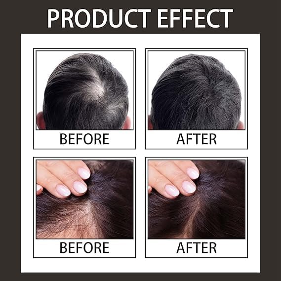 GLNRM Hairline Shadow Powder Hairline Shadow Powder Hair Filler Powder For Thinning Hair Magical Fluffy Thin Hair Powder Forehead Grooming Powder Instant Coverage For Hairline Black Gram - Image 3