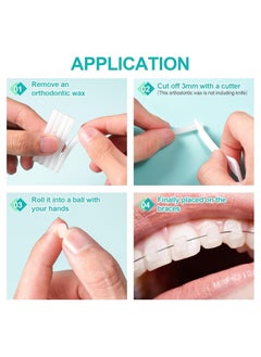 SYOSI 5 Boxes Dental Wax for Braces Dental Special Protective Wax Orthodontic Wax for Orthodontics Braces Wearer for Braces Wearer Aligners Brackets 5 Different Flavours  - Image 3