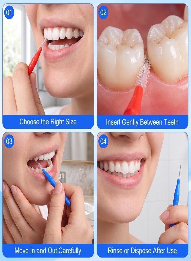 lanjue 100 Pcs Interdental Brushes for Braces, Braces Brush for Cleaner Toothpicks Soft Dental Floss Picks Teeth Cleaning Tools Braces Cleanerfor Teeth Oral Cleaning(Red,Blue - Image 4