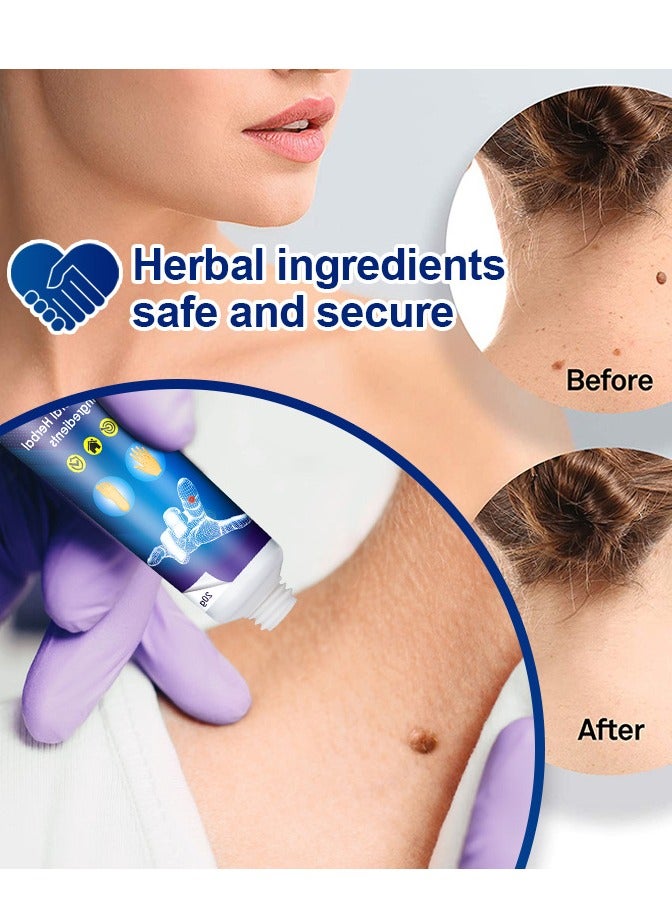 Sumifun Instant Blemish Removal Gel, Wart Removal Body Warts Treatment Cream Foot Care Cream Skin Tag Remover, Body Treatment Ointment, Wart and Callus - Effective and Scar-Free - Image 4