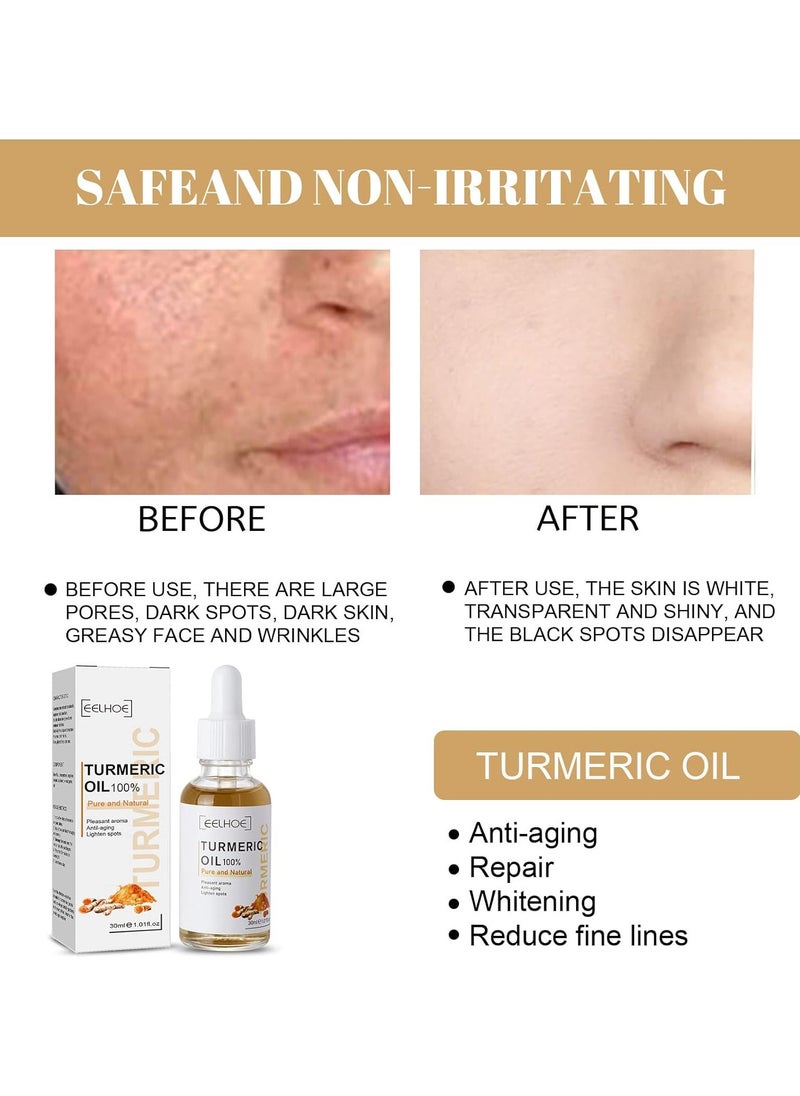 EELHOE - Turmeric Freckle Whitening Face Serum Remove Melasma Pigment Anti Aging Fade Dark Spots Fine Lines Repair Beauty Skin Care - Image 1