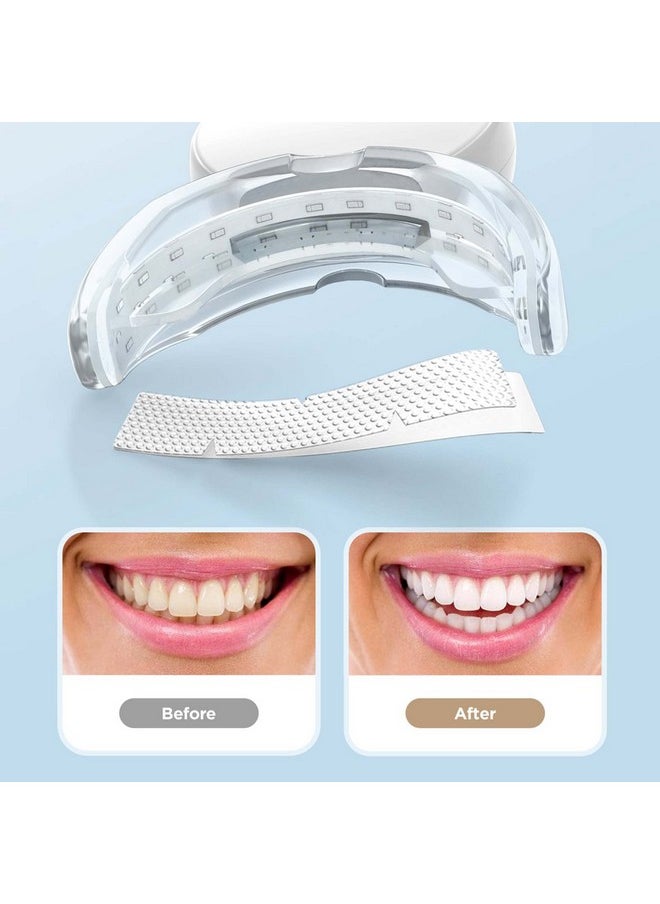 AGARO - Dazzle Instant Teeth Whitening Kit With 14 Pcs Strips, Manual Dental Whitening Kit For Adults, Oral Care, 24 Blue Led Light, Rechargeable, Removes Teeth Stains, Non Sensitive, Gentle & Safe - Image 1