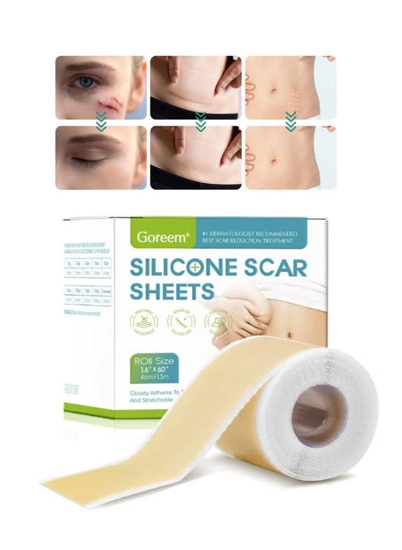 Goreem Silicone Scar Sheets,Silicone Scar Tape,Reusable Efficient Cosmetic Scar Removal Suitable for Caesarean Section Burns Keloid Acne and Other Scar Removal Stickers (4cm x 1.5m) - Image 5