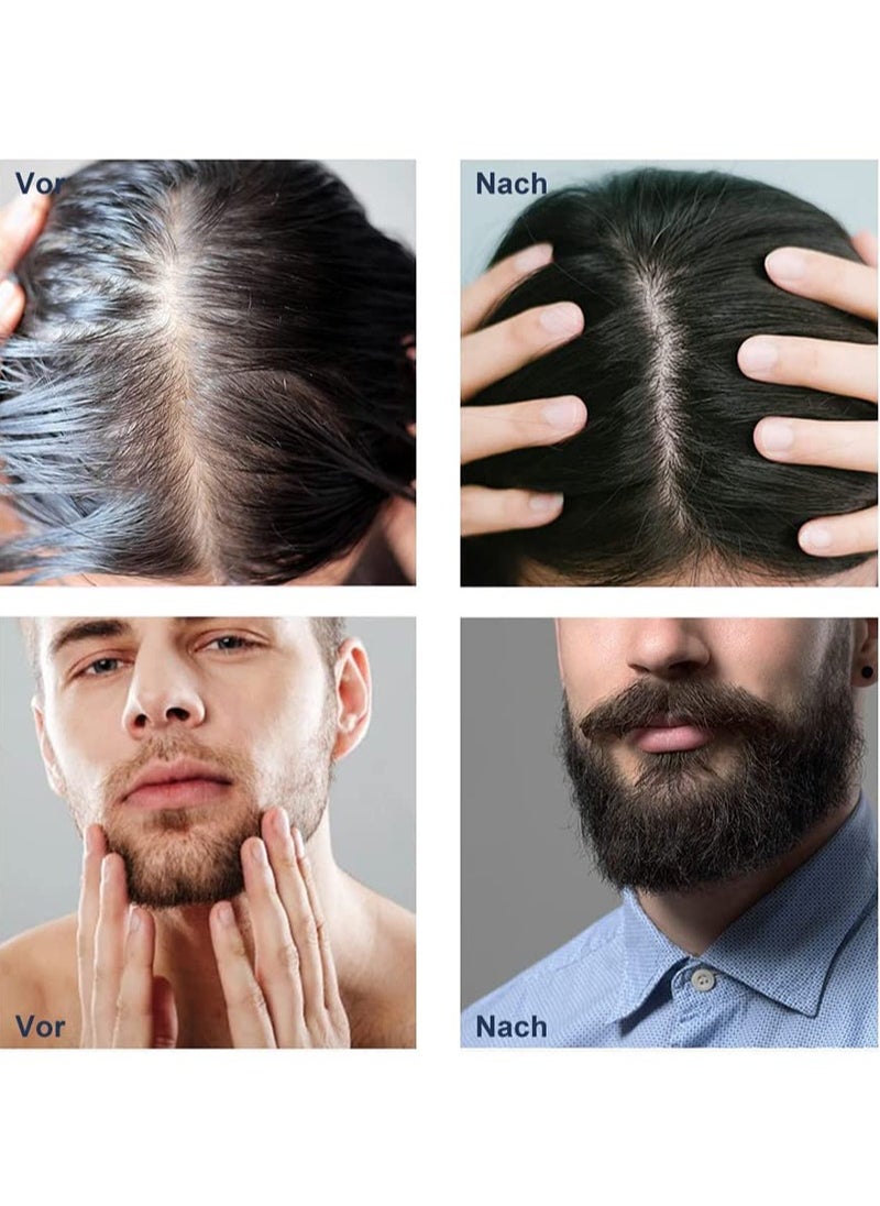 Beard Roller 0.5 mm - 540 Titanium Real Needles for Ultra Beard Growth - More Beard Growth with Beard Roller Beard Roller Face Roller Derma Roller - Microneedle Tool - https://f.nooncdn.com/p/pzsku/Z6D143C78589C52E7F0D1Z/45/_/1716360120/c59908b2-c9e2-4759-ac66-9ab8ca8a6677.jpg?width=original