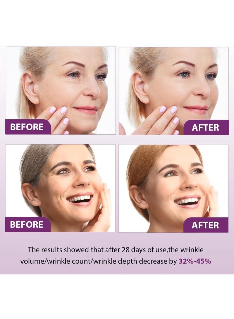 PHANSTA Bakuchiol Retinol Serum, Retinol Rejuvenation Serum for Anti-Wrinkles and Glowskin, Retinol Face Serum for Men & Women - Image 5