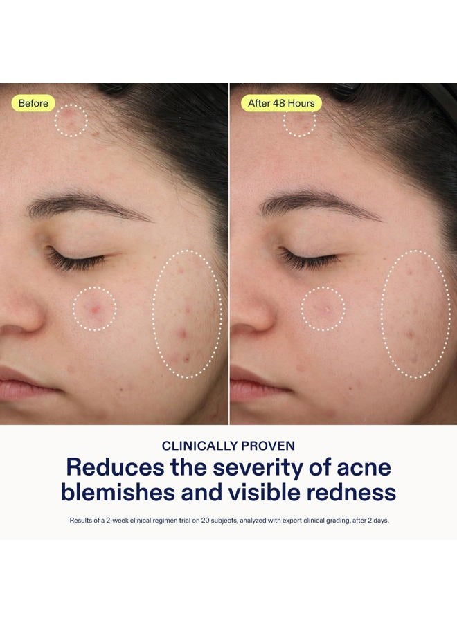 Skinfix Acne+ 2% BHA Acne Spot Treatment: Clinical-Strength, Rapid-Acting Acne Treatment that Reduces Blemish Size and Redness, Plus Prevents New Acne Pimples from Forming, 0.5 oz - Image 3
