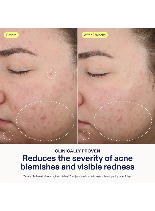 Skinfix Acne+ 2% BHA Acne Spot Treatment: Clinical-Strength, Rapid-Acting Acne Treatment that Reduces Blemish Size and Redness, Plus Prevents New Acne Pimples from Forming, 0.5 oz - Image 4
