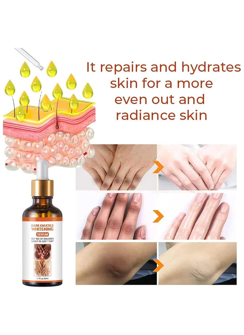 West&Month Dark Spot Corrector Dark Knuckle Whitening Serum Even Skin Tone Improve Dullness Skin Lightening Serum for Underarms, Elbows, Chest, Knees  - Image 4