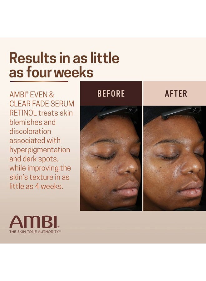 ambi Even & Clear Fade Serum, Hyperpigmentation Treatment, Hydroquinone-free, Dark Spot Corrector, Results In As Little As 4 Weeks, Retinol, Hyaluronic Acid, Niacinamide, Ceramides, 1 Fl Oz - Image 5