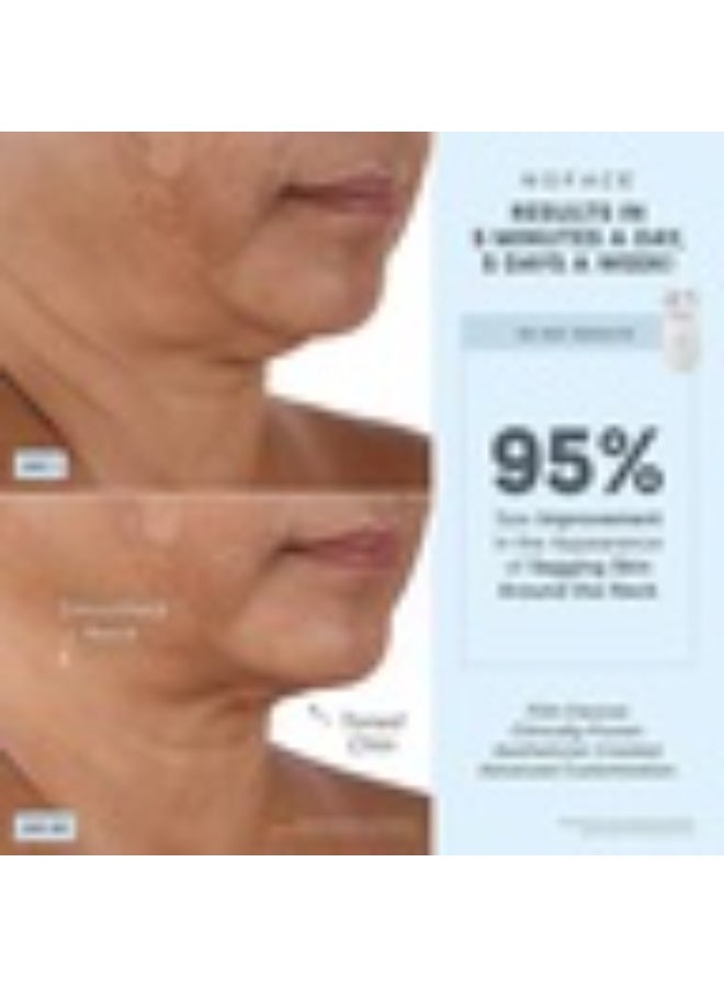 NuFace NuFACE Trinity+® Effective Lip & Eye Attachment 1 piece - Image 2