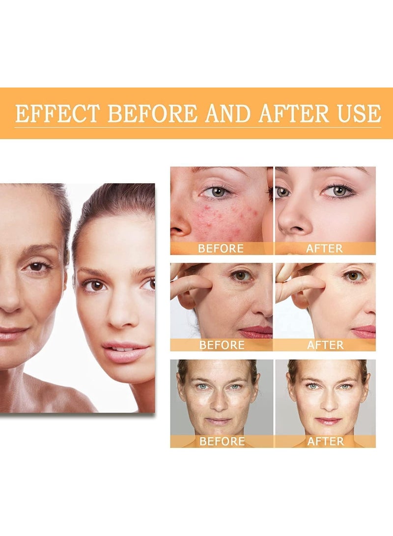 BeautyVoc Glycolic Acid 7% Solution, Fades Dark Spots & Exfoliates for Radiant Skin, 30ml - Image 4