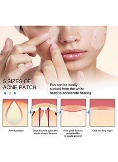 EELHOE Pimple Patches 1 packs of 80 sheets Skin Tag Acne Removal Patches 5 Sizes for Acne pimples of different sizes and shapes and for Blemish Moles Skin Tags  - Image 5
