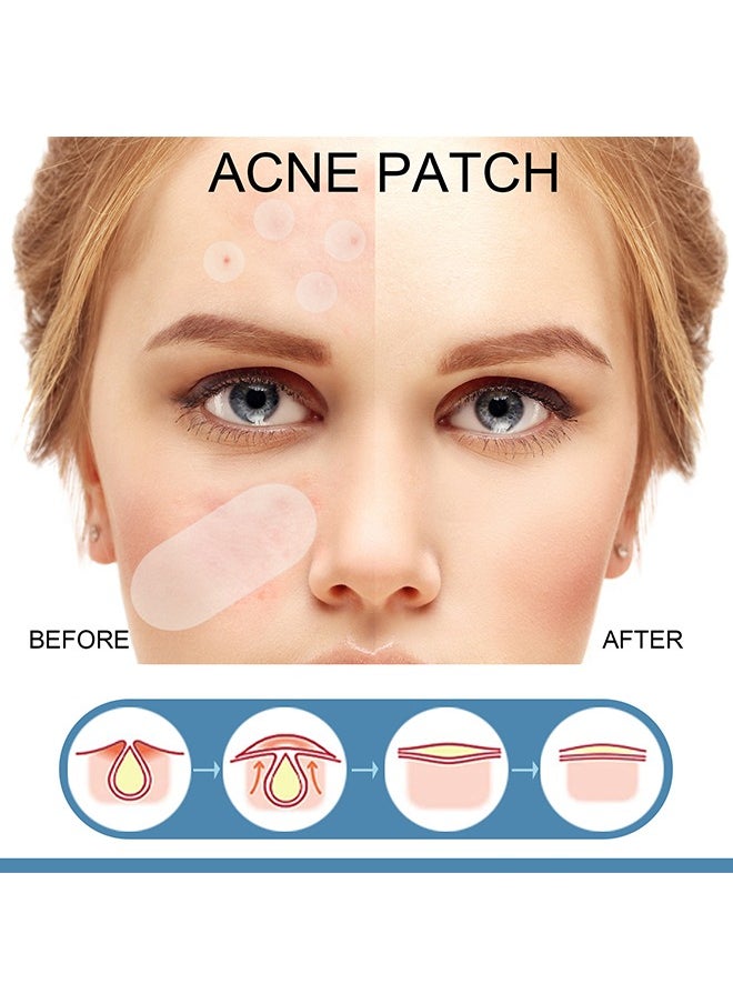 Pimple Patches 1 packs of 80 sheets Skin Tag Acne Removal Patches 5 Sizes for Acne pimples of different sizes and shapes and for Blemish Moles Skin Tags
