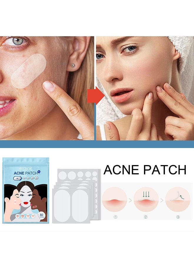 Pimple Patches 1 packs of 80 sheets Skin Tag Acne Removal Patches 5 Sizes for Acne pimples of different sizes and shapes and for Blemish Moles Skin Tags