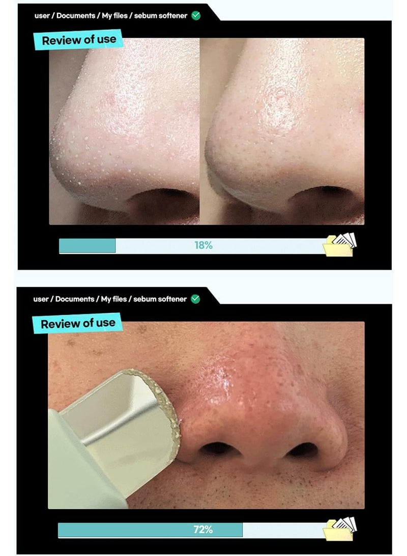 ILSO Super Melting Sebum Softener, 5.29 fl oz, with 40 Cotton Pads included - Image 3