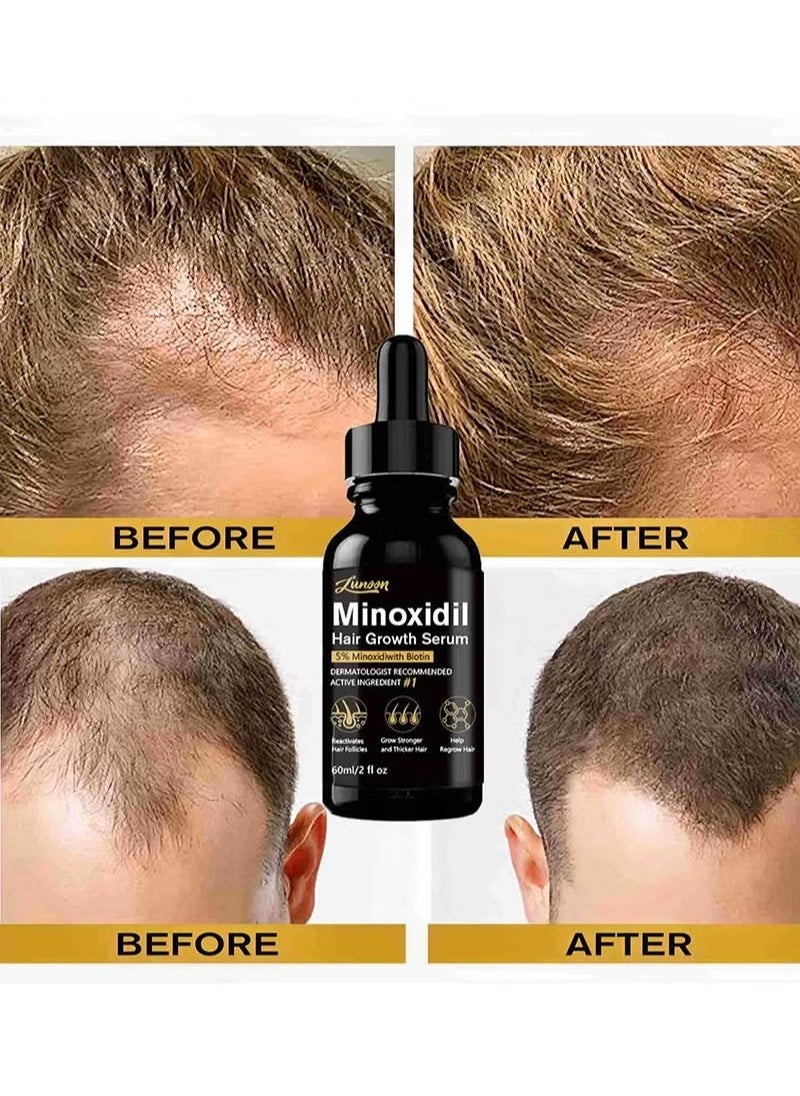 5% Minioxidil Hair Growth Serum for with Biotin Regrowth Hair Treatment For Thickens Hair Promotes Hair Density Help to Stop Thinning loss Hair stimulates Hair Growth, Regain Hair Serum-60ml - pzsku/Z6D4E2F957CE44D419119Z/45/_/1736934113/18a261f8-2bc4-4cb6-9fd1-c9a8104a8ab1