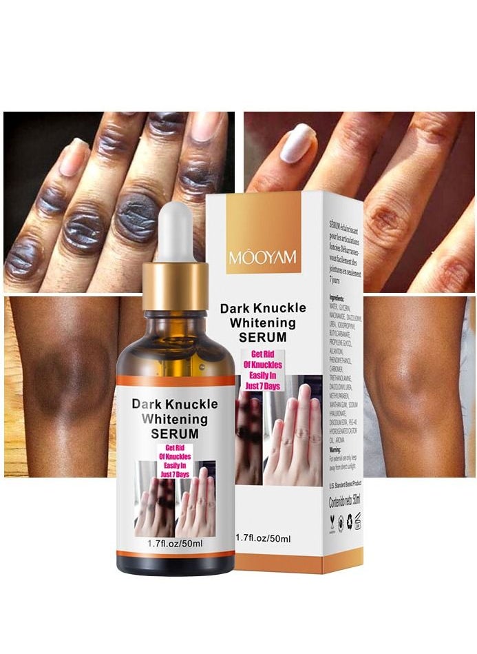 MOOYAM Dark Knuckle Whitening Serum 7 days Treatment for Dark Spots in Hand and Feet Knuckles Exfoliating Improves Dullness Powerful Whitening Effect for Men and Women 50ml  - Image 1