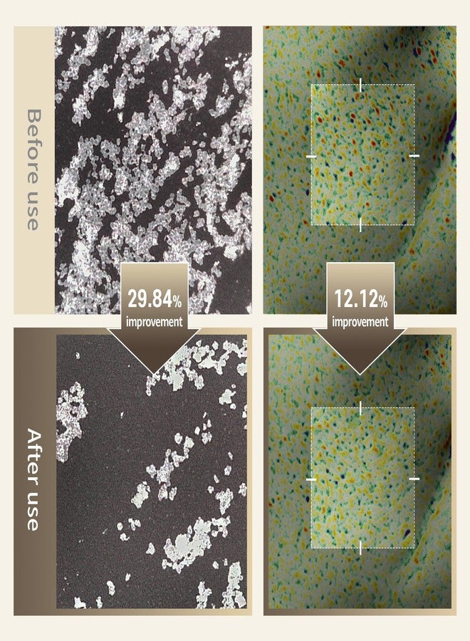 Benton Glycolic Acid 7% Exfoliating Toner with Niacinamide - Gentle AHA Toner for Brighter Skin & Even Tone - Balances Oil & Moisture - Hydrating, Cruelty-Free Korean Skin Care - Image 2