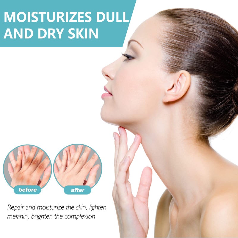 Nigrifix Acanthosis Nigricans Therapy Cream,Dark Spot Remover For Body,Dark Spot Corrector Cream,- Underarm, Neck, Armpit, Knees, Elbows, Private Areas, Intimate Areas - Upgraded Formula, - 2.1Fl Oz - Image 4