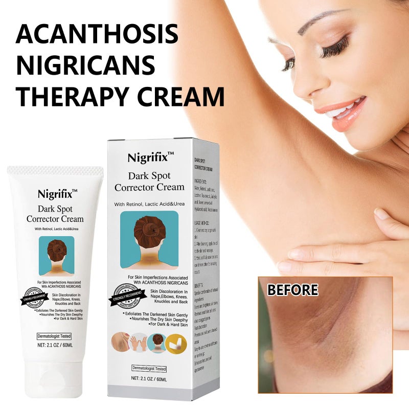 Nigrifix Acanthosis Nigricans Therapy Cream,Dark Spot Remover For Body,Dark Spot Corrector Cream,- Underarm, Neck, Armpit, Knees, Elbows, Private Areas, Intimate Areas - Upgraded Formula, - 2.1Fl Oz - Image 3