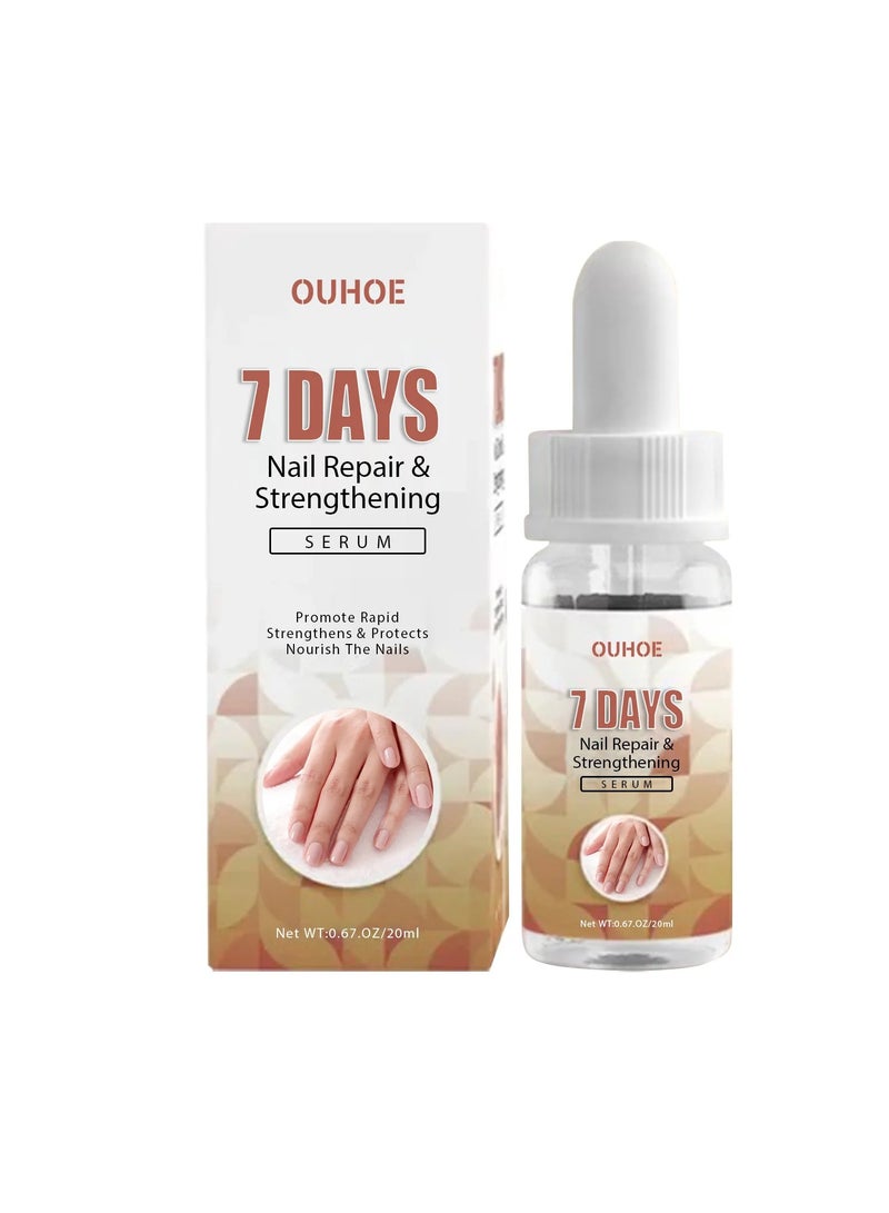 Nail Repair Serum 7 Days Nail Growth And Strengthening Serum Anti Fungal Infection Paronychia Onychomycosis Treatment Serum Nourishing And Strengthening Nail Regrowth Care Oil