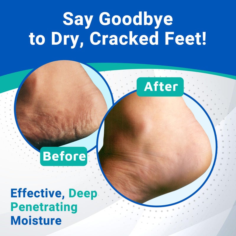dermal therapy علاج الجلد - كريم العناية بالكعب، كريم للقدمين للبشرة الجافة والمتشققة، مرطب مكثف للقدمين مع اليوريا و AHA، لوشن للقدمين ومقشر للقدمين بتركيبة غير دهنية، 3 أونصة. - Image 4