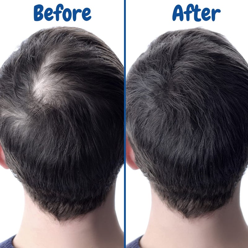 Verseo Sup Hair Growth Conditioner Treatment | Conditioner for Thinning Hair and Hair Loss | Repairing Damaged Hair | 28 Day Supply - Image 5
