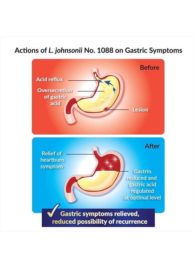 LABO Nutrition - GASTRICELL - Addresses H. Pylori, Acid Reflux, Heartburn - Natural Defence Against Gastric Distress, 30 Sachets - Image 1